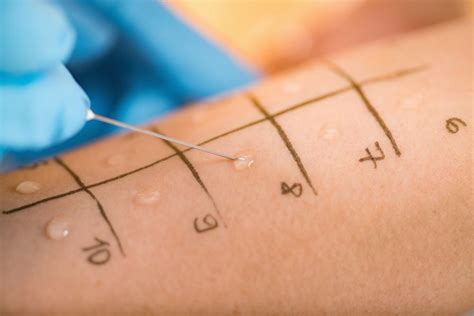 advil impact allergy tests|best medication for skin allergy testing.